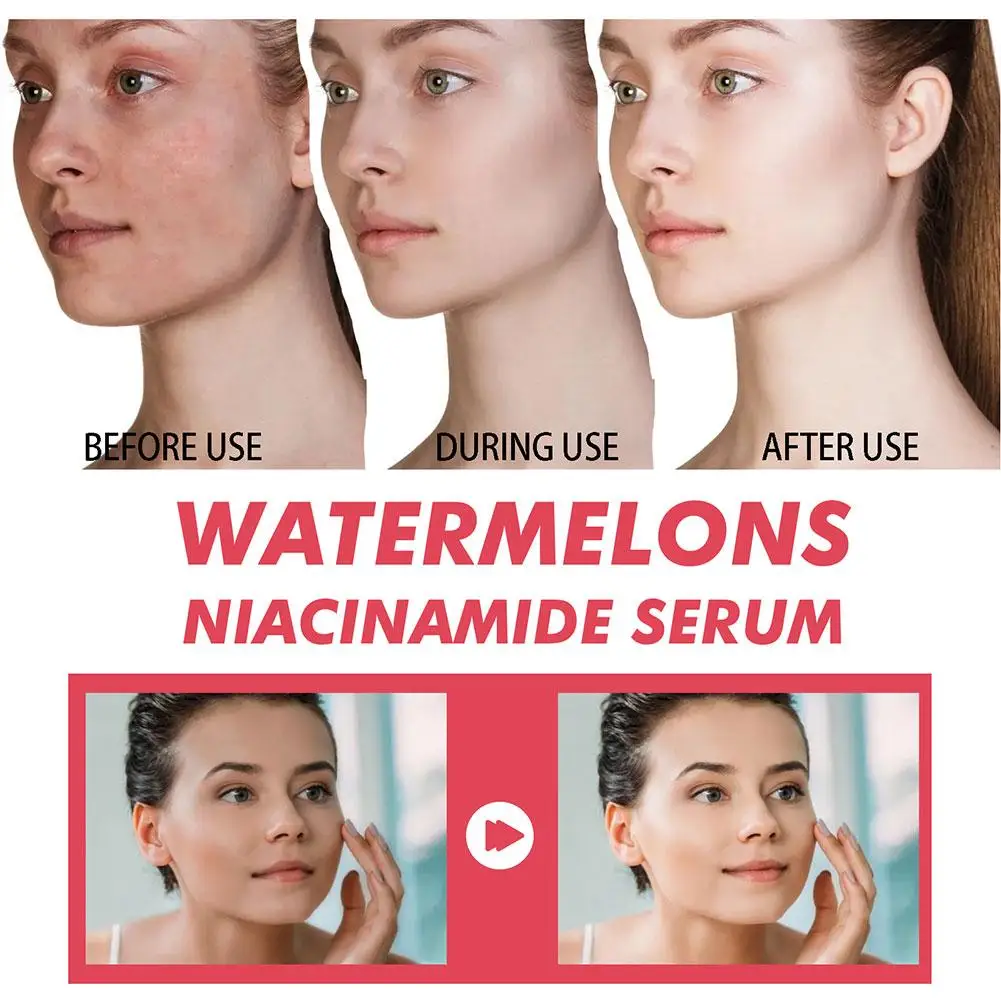 Watermelon Glow Niacinamide Mo – Niacinamide Brightening Serum Bewertung und Preis