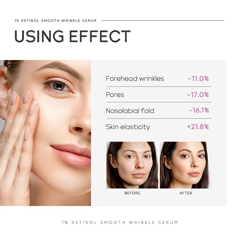 Quiyum 1% Retinol Anti-Falten- – Niacinamide Brightening Serum Bewertung und Preis